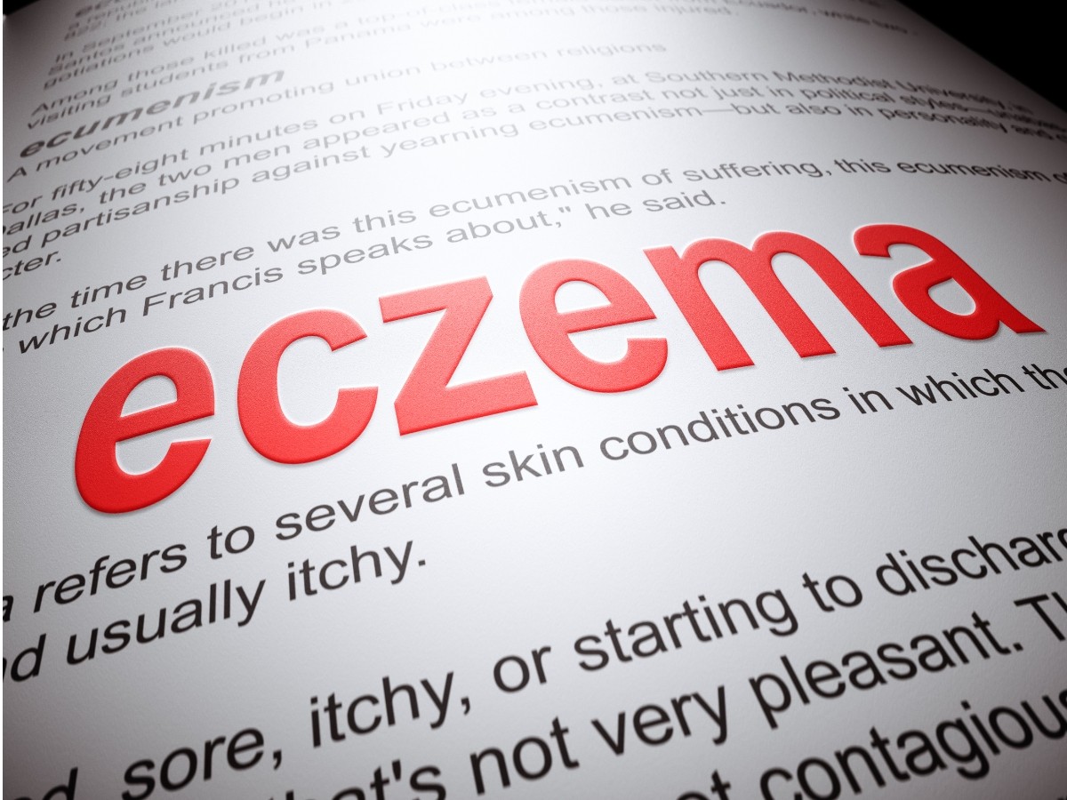 Eczema: What is it and how to treat it naturally?